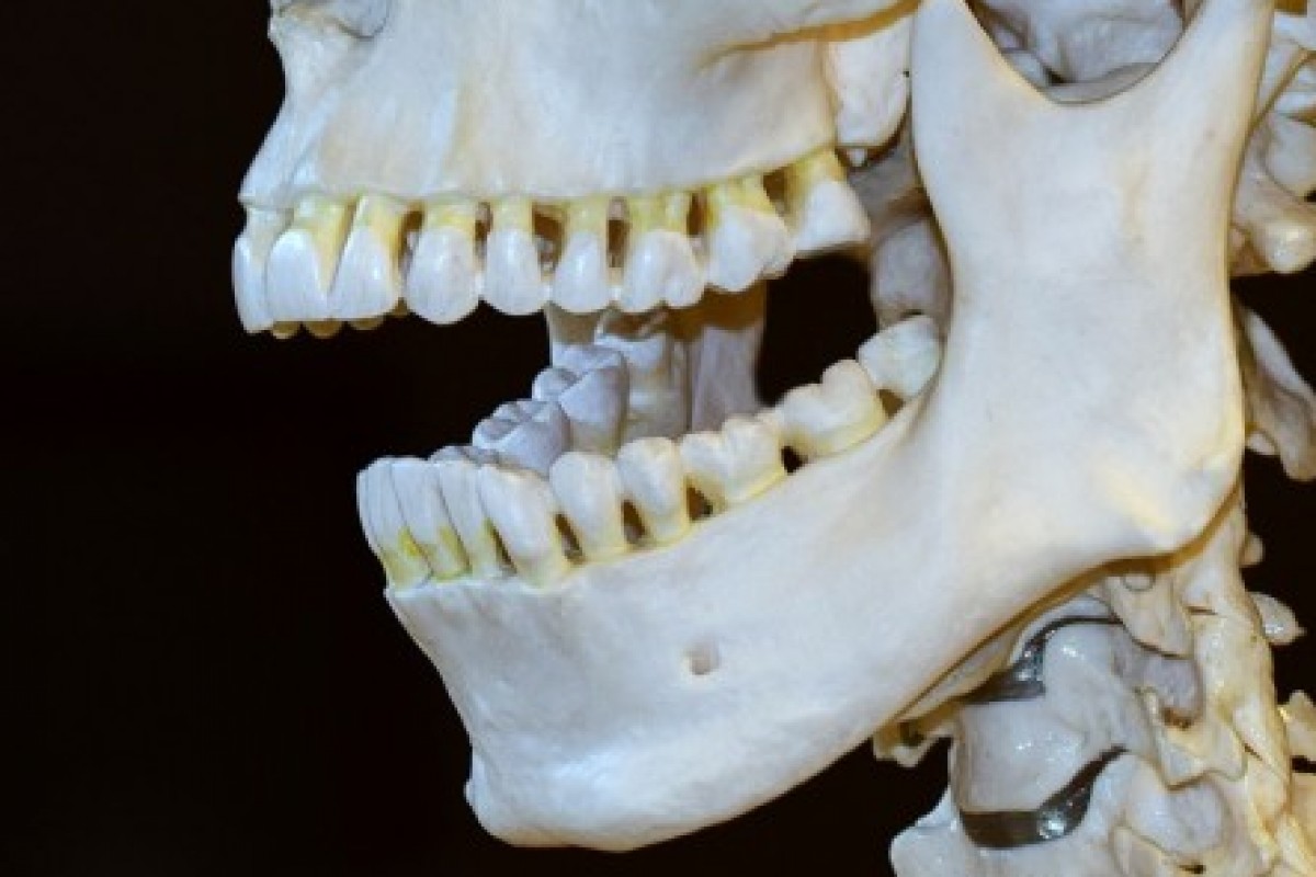 El origen del Alzhéimer puede estar en una infección en la boca